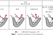 灵动致臻 柔韧致远｜远大医药经导管二尖瓣夹系统NeoNova®开启全国首批植入
