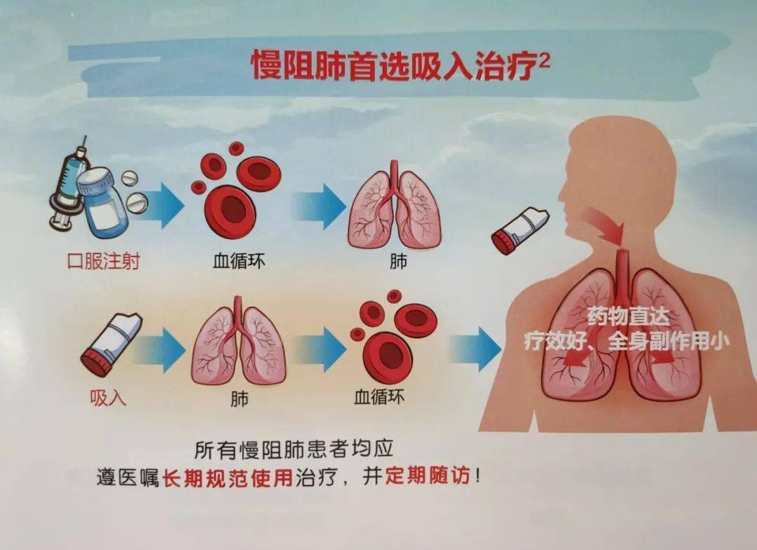 世界慢阻肺日：这些常识要留意